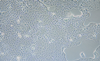 Calu-3人肺腺癌細(xì)胞（胸水）細(xì)胞鑒定